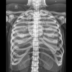 X-Ray/Radiographic Positioning Doll