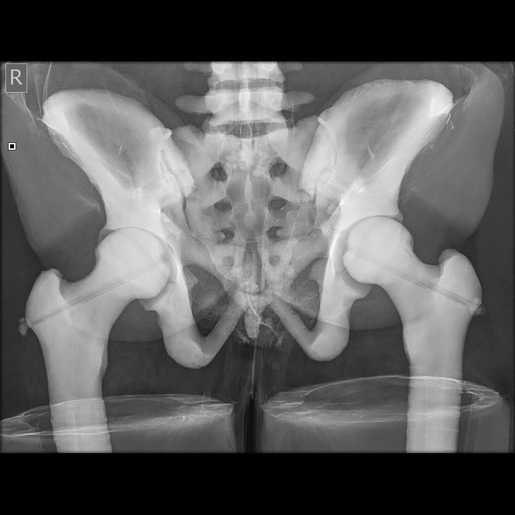 X-Ray/Radiographic Positioning Doll