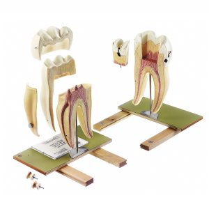 Right Lower First Molar