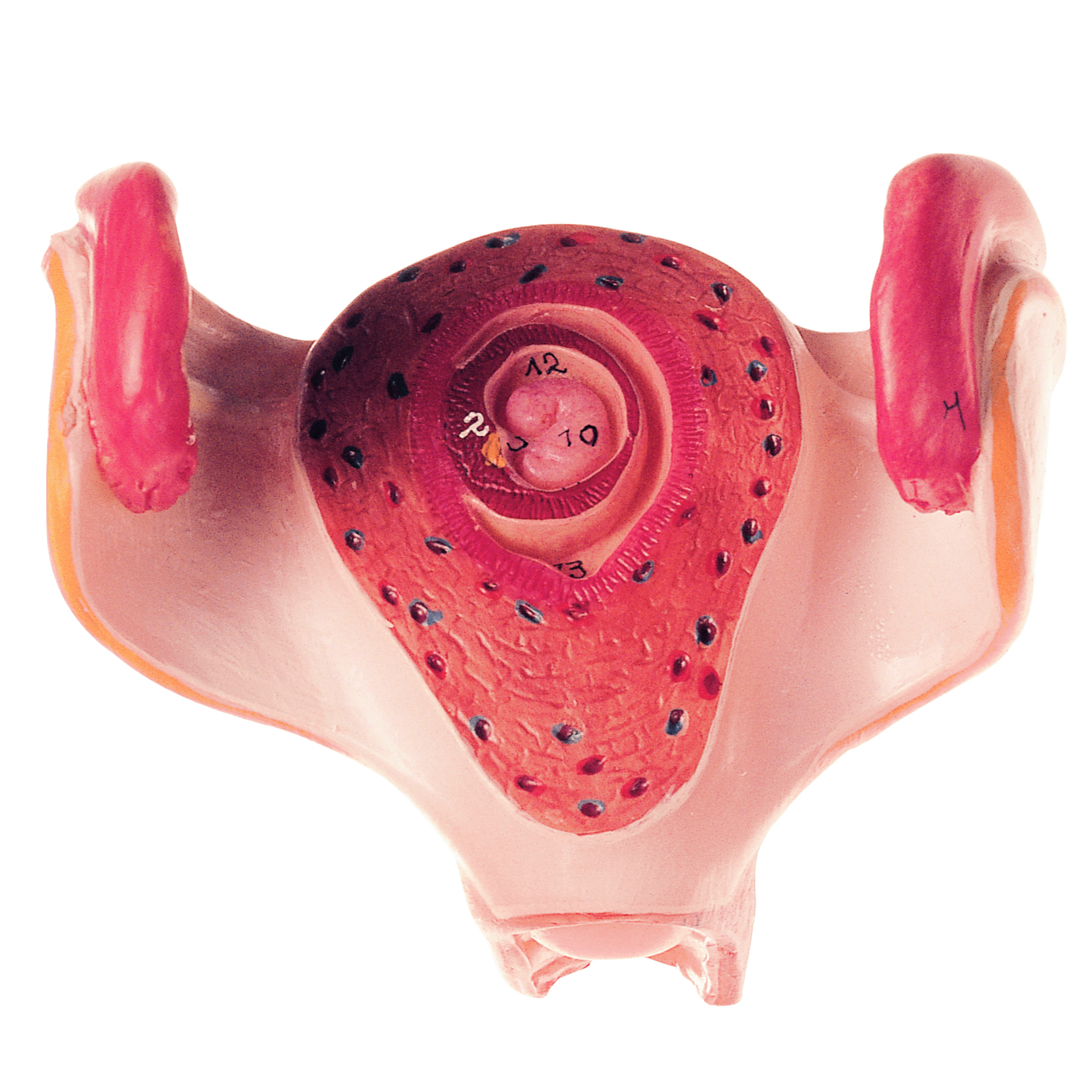 Uterus With Embryo in First Month