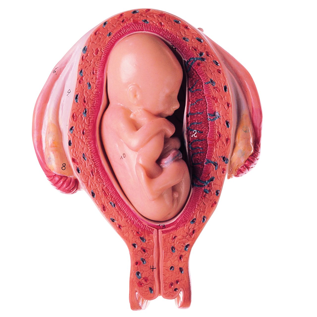 Series Showing Pregnancy
