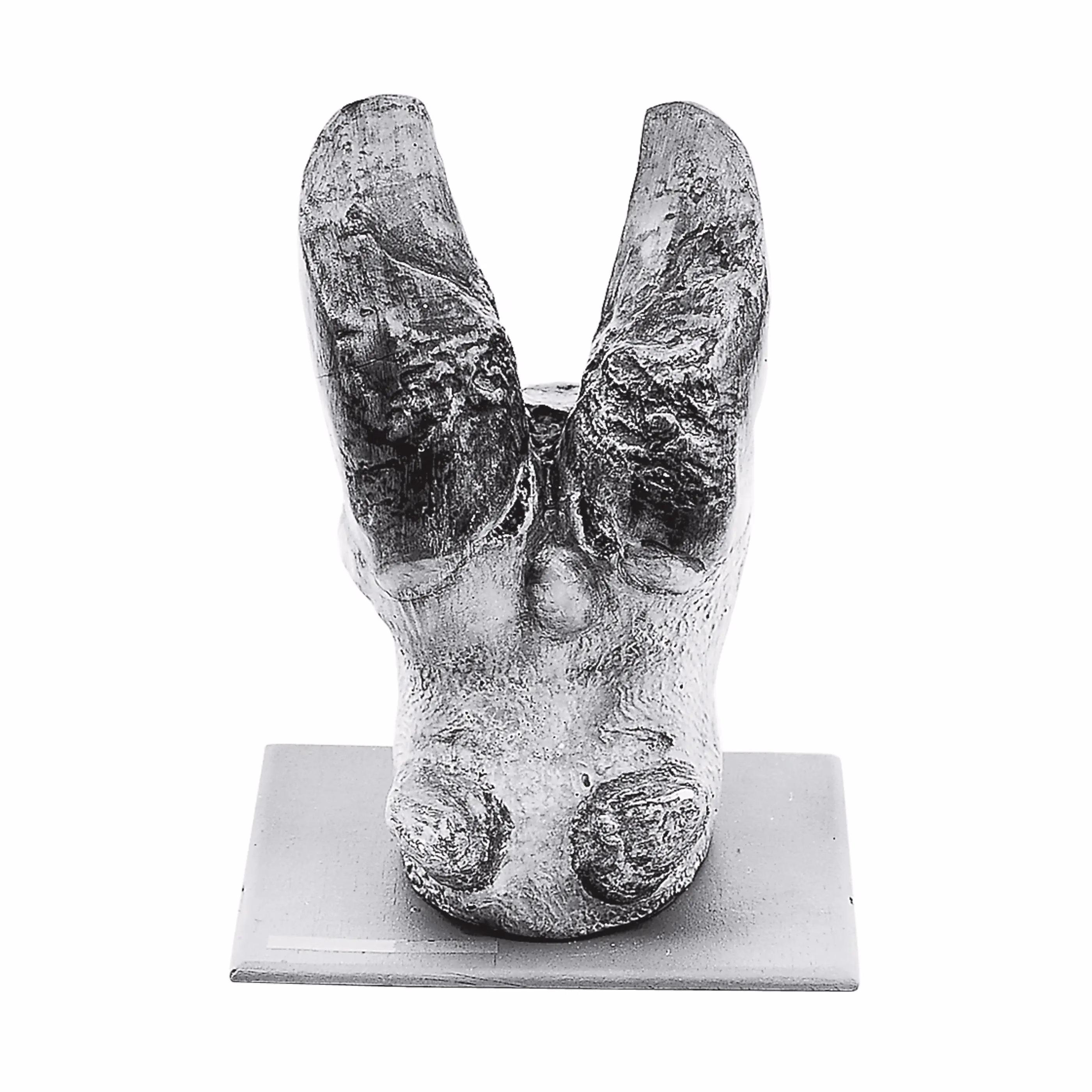 Cow’s Hoof With Foot Disease