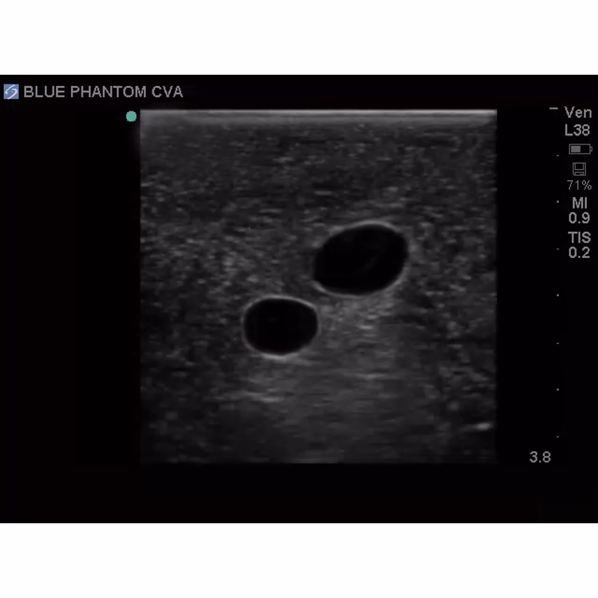 Tissue Insert For Gen I Central Venous Access, With Hand Pump