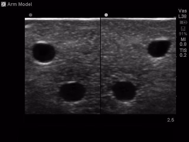 Peripheral Doppler Ultrasound Training Model Package