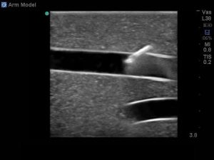 Peripheral Doppler Ultrasound Training Model Package