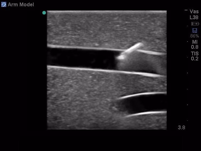 Peripheral Doppler Ultrasound Training Model Package