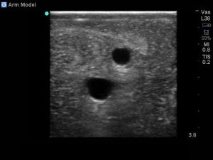 Peripheral Doppler Ultrasound Training Model Package
