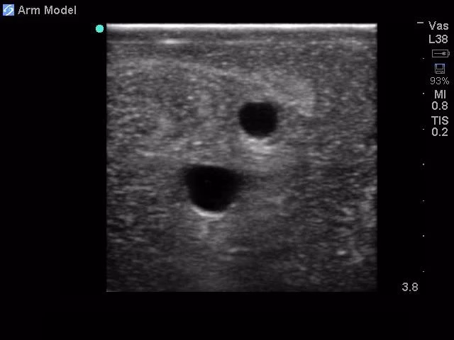 Peripheral Doppler Ultrasound Training Model Package