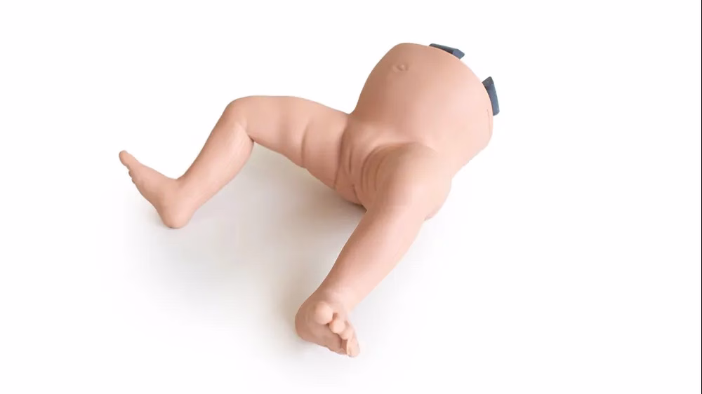 Infant Hip Exam - Lower Abnormal, Light