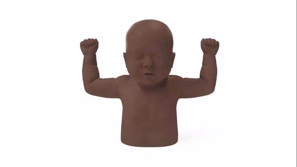 Infant Hip Exam - Upper, Dark