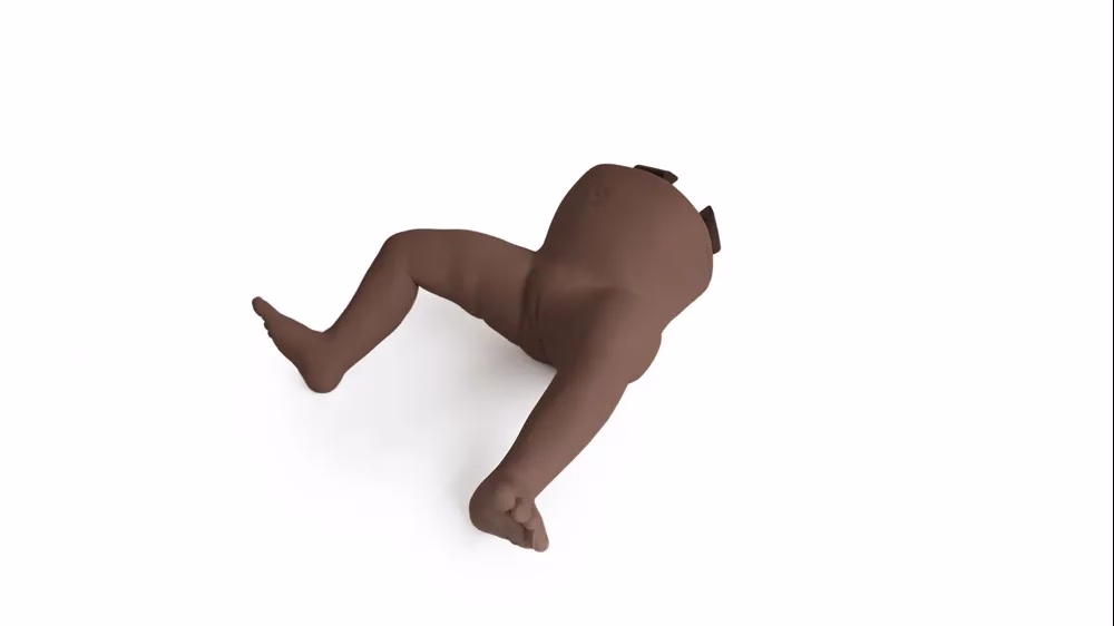 Infant Hip Exam - Lower Normal, Dark