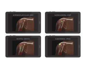 Shoulder Injection Trainer Palpation Guided without Tablet, Light