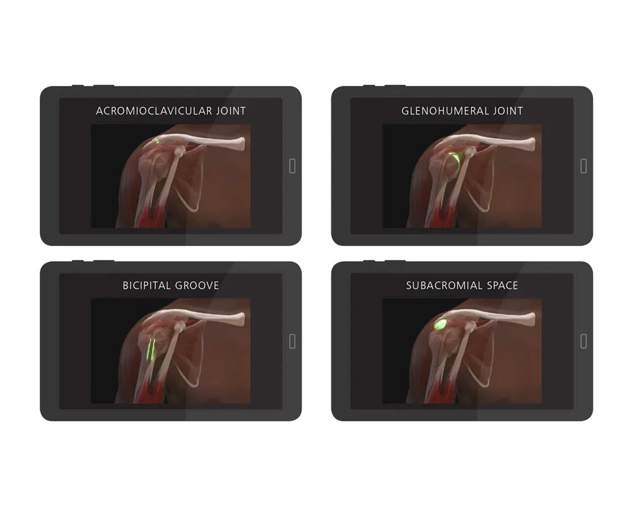 Shoulder Injection Trainer Palpation Guided without Tablet, Light