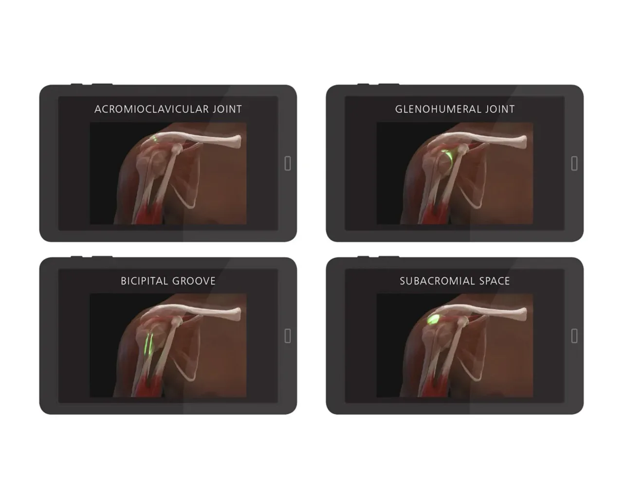 Shoulder Injection Trainer Palpation Guided without Tablet, Dark