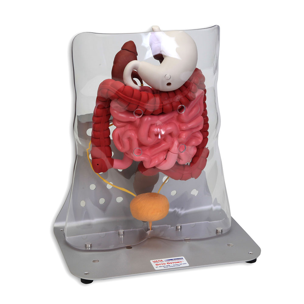 Otto Ostomy™ Standard Stoma Model