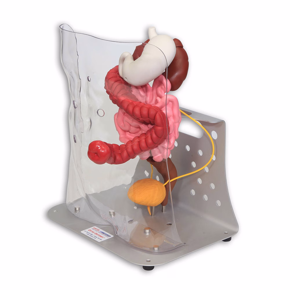 Otto Ostomy™ Standard Stoma Model