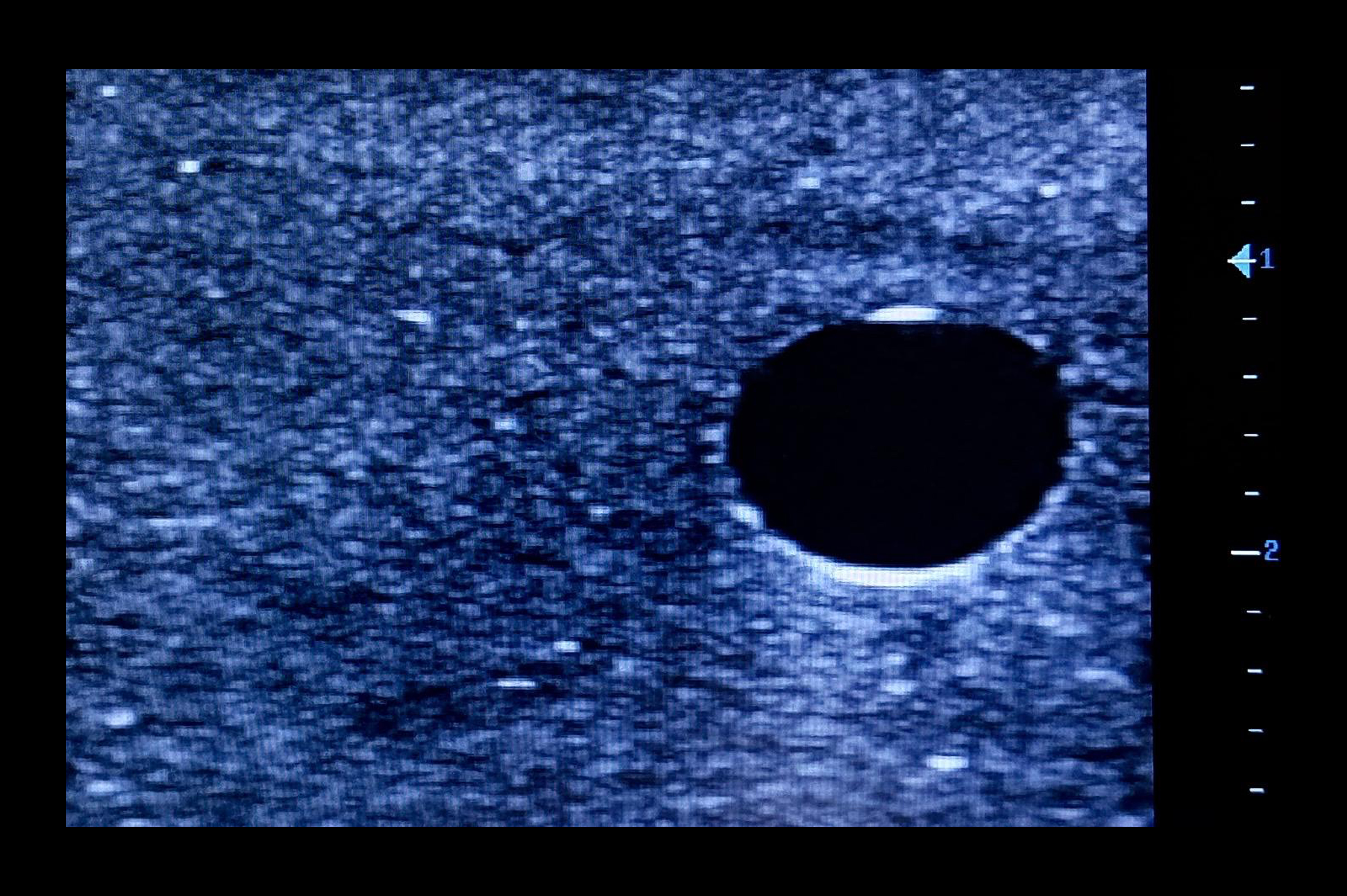 Ultrasound Simulator with 2 Peripheral Veins, Dark