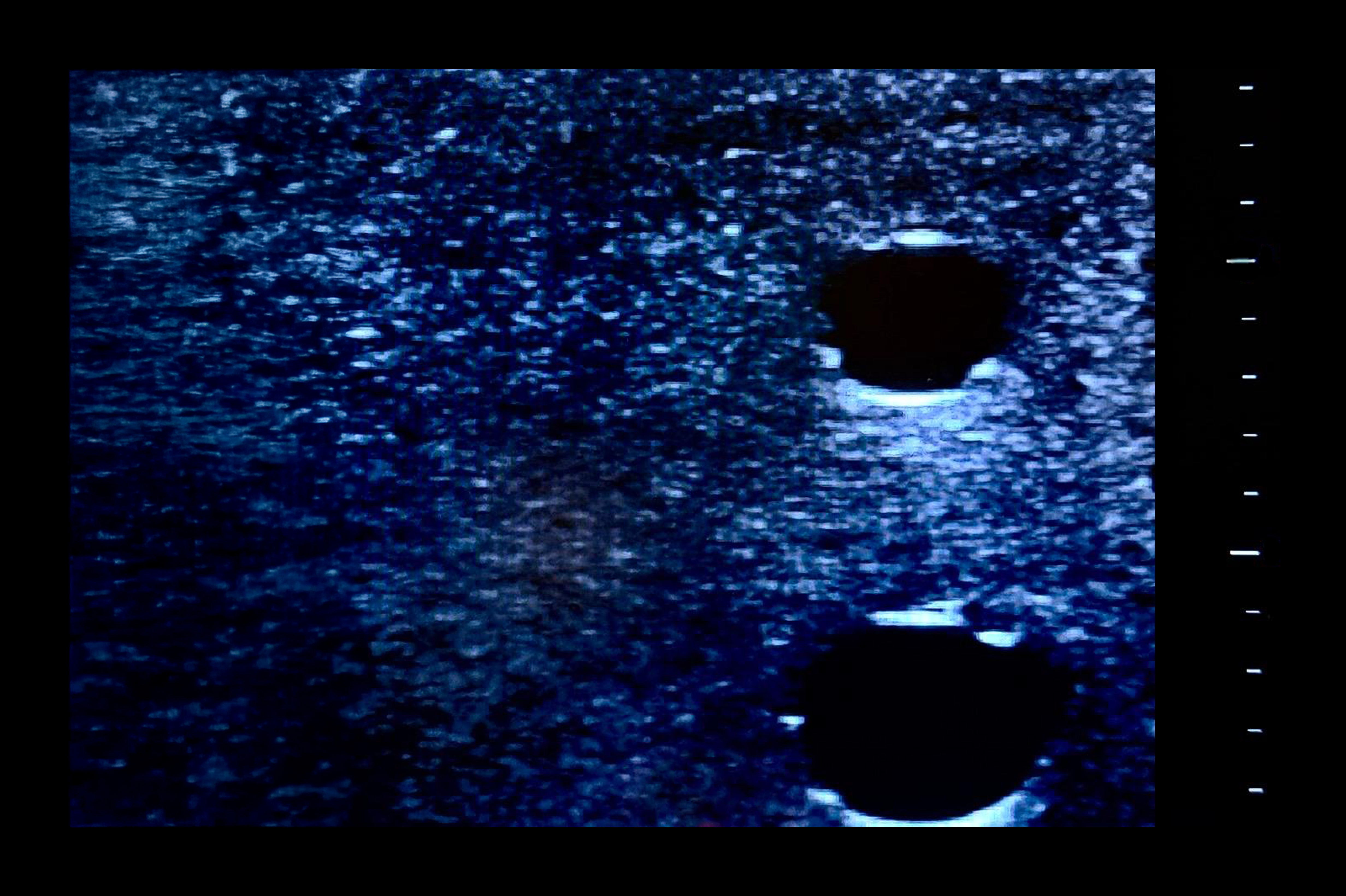 Ultrasound Simulator with 4 Central Lines, Dark