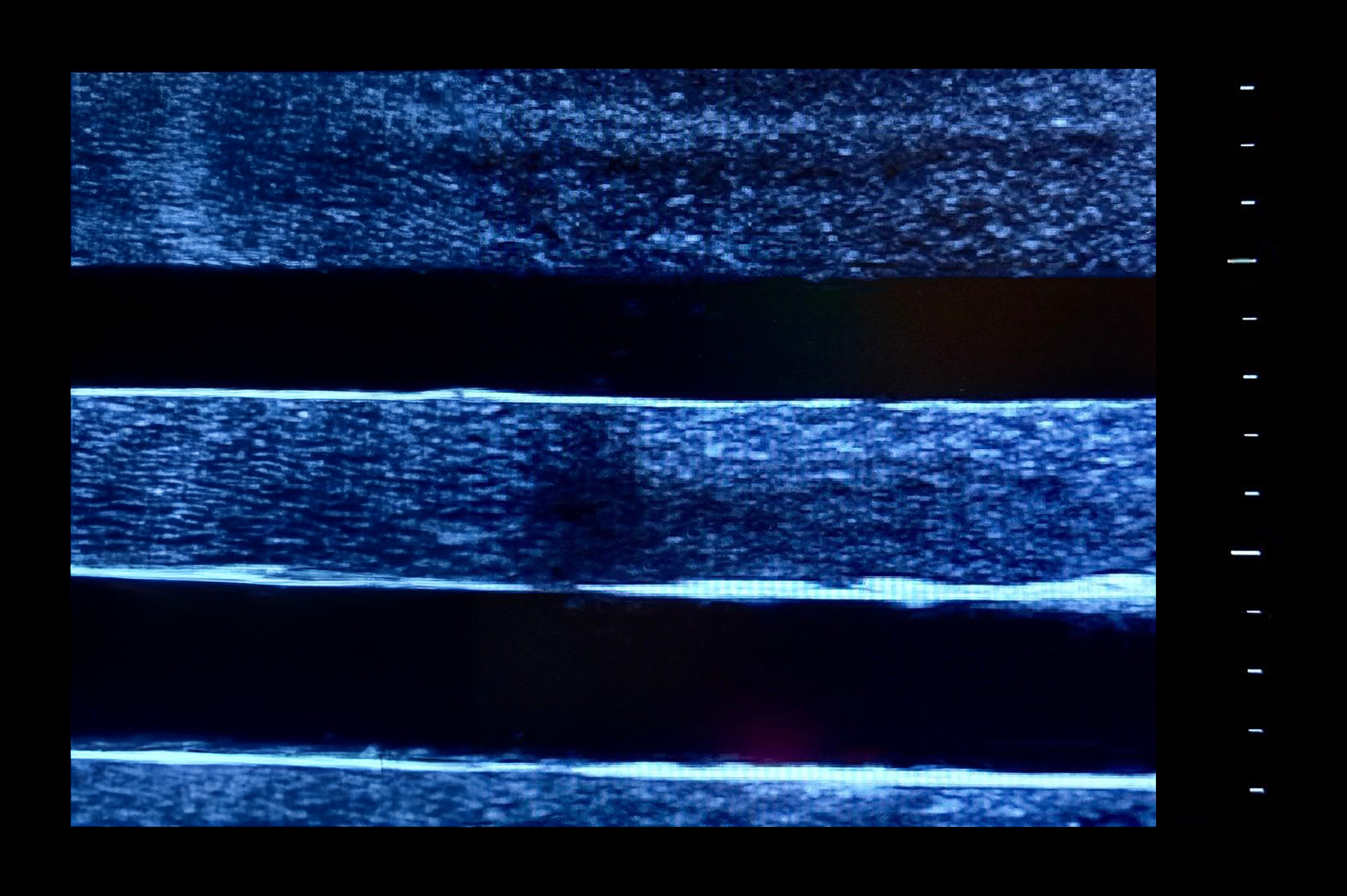 Ultrasound Simulator with 4 Central Lines, Dark