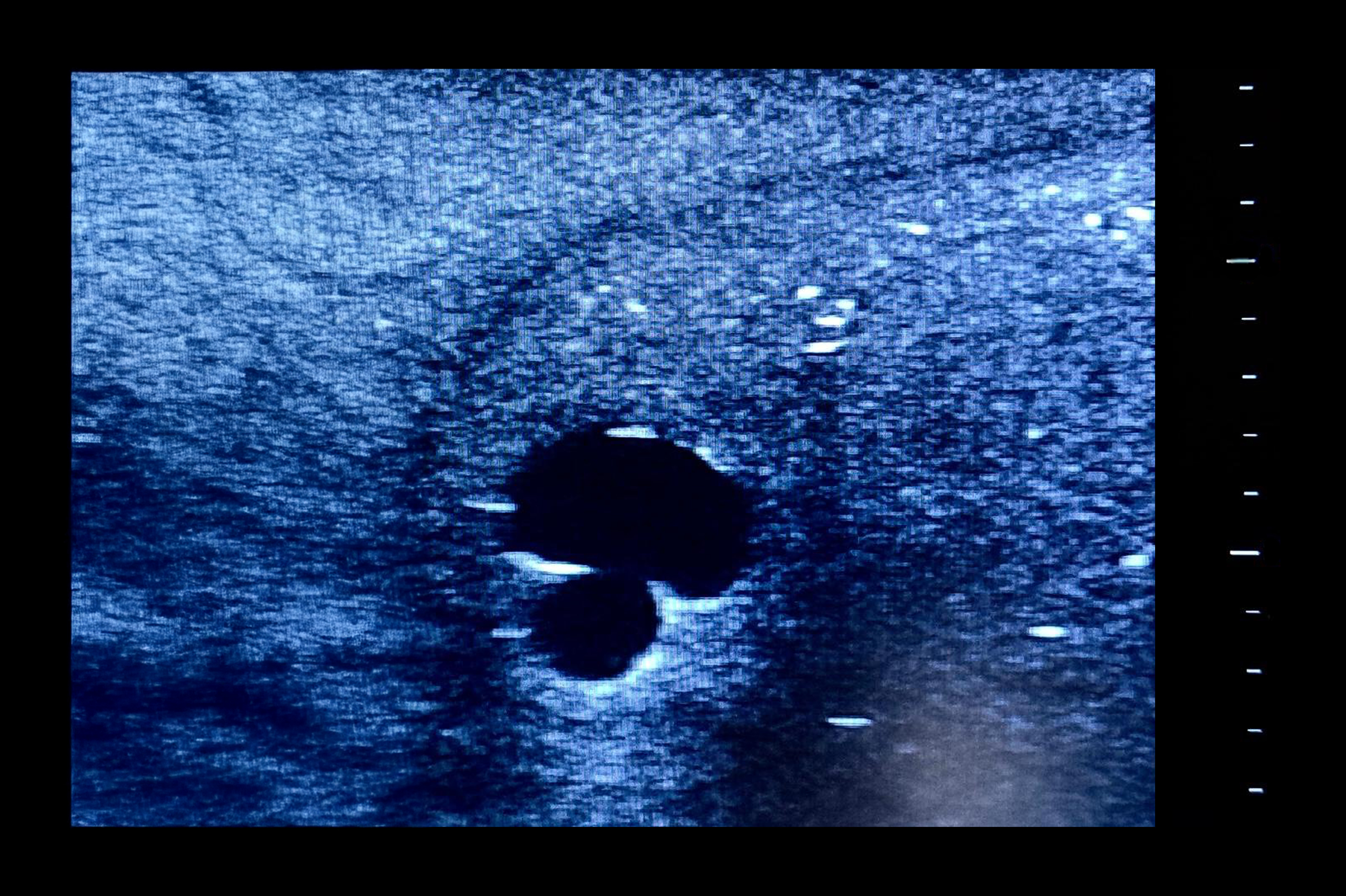 Ultrasound Simulator with 2 Branched Veins, Dark