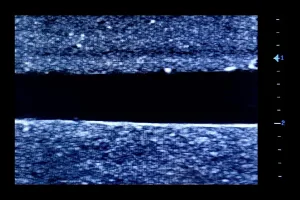 Ultrasound Simulator with 2 Femoral Access Routes, Dark