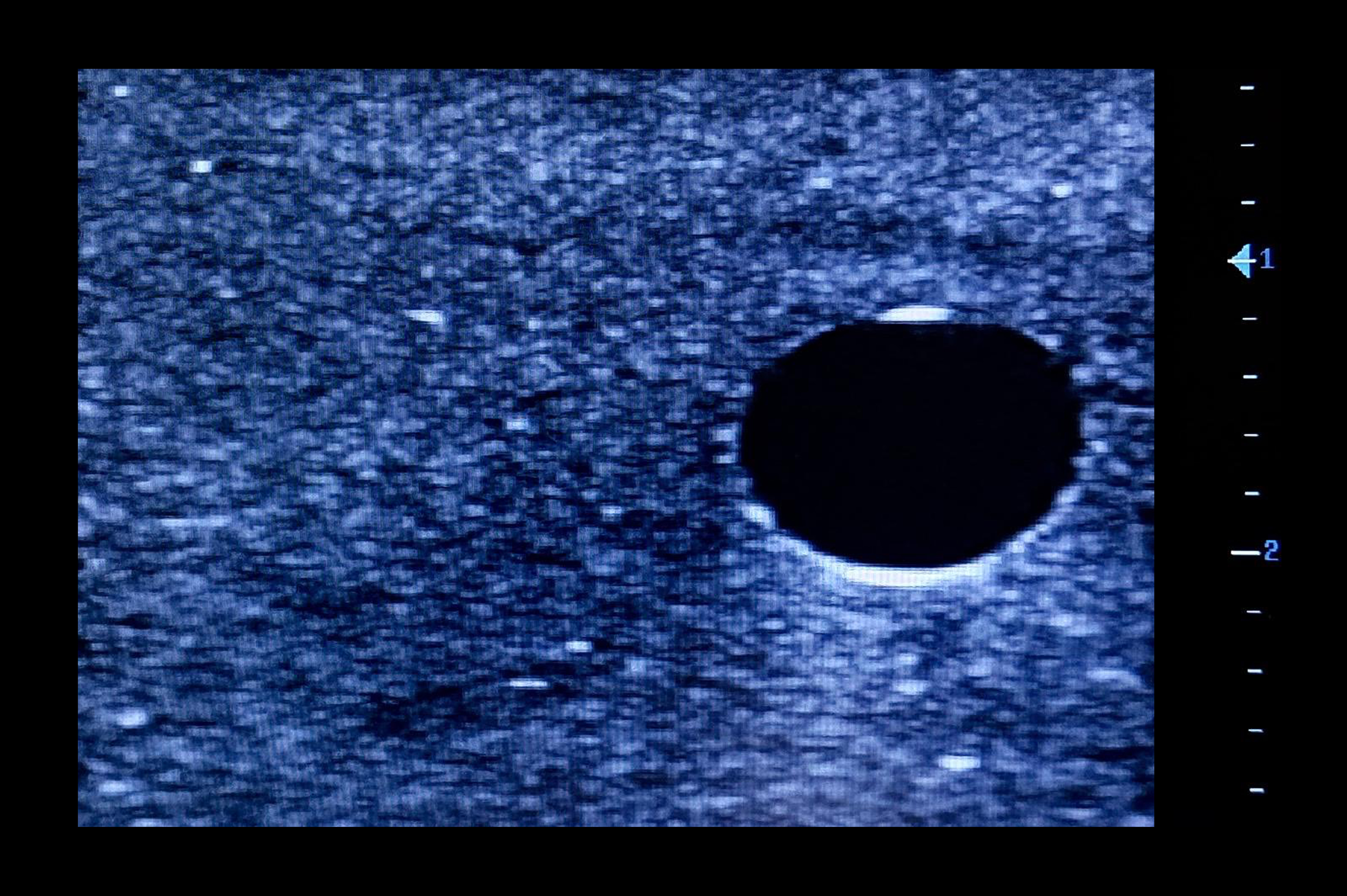 Ultrasound Simulator for Seldinger Technique, Dark