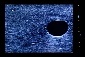 Ultrasound Simulator with 2 Central Lines, Dark