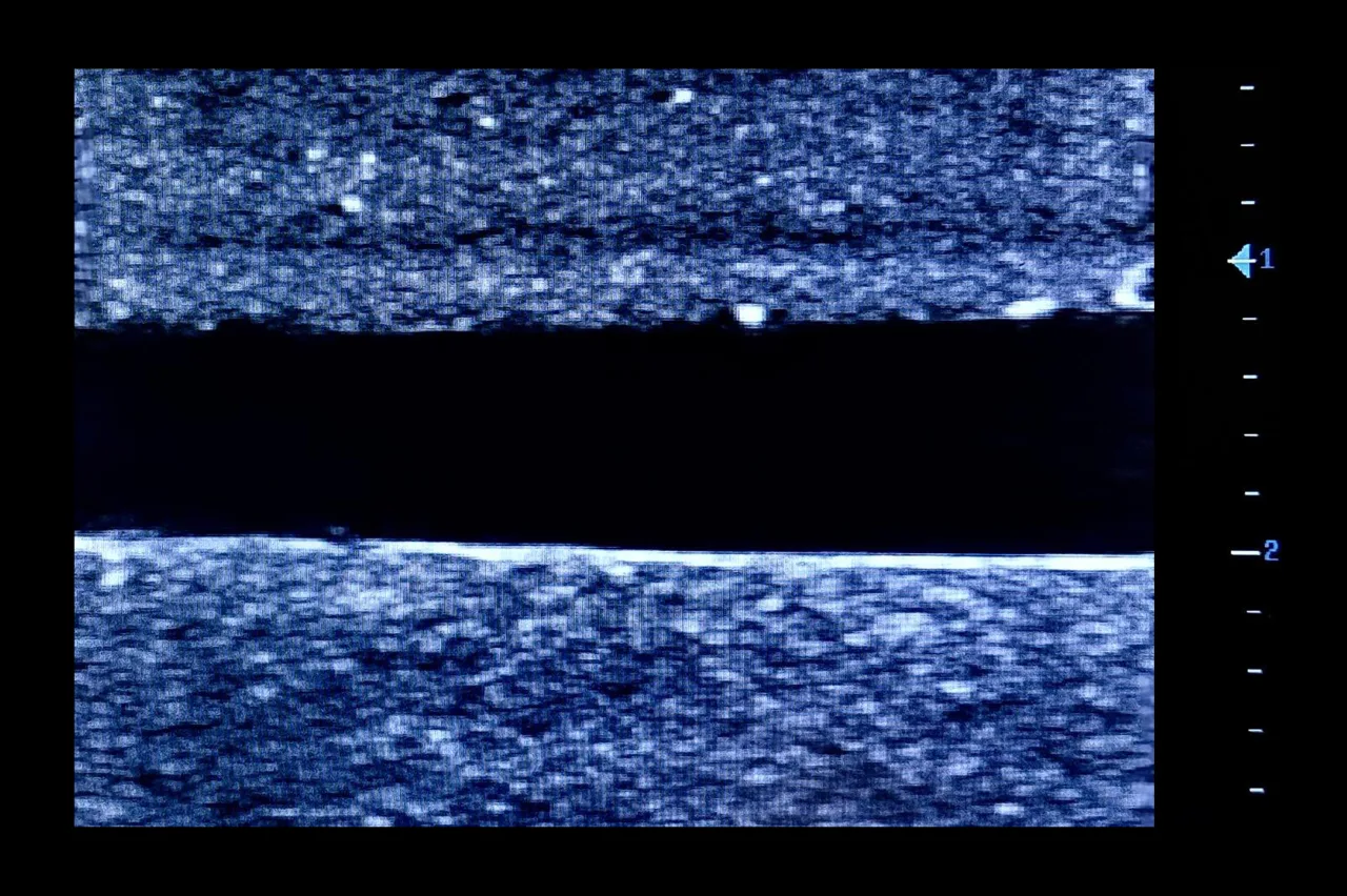 Ultrasound Simulator with 2 Central Lines, Dark