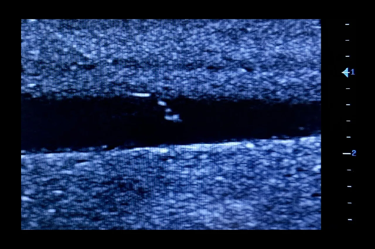 Ultrasound Simulator for Seldinger Technique, Light
