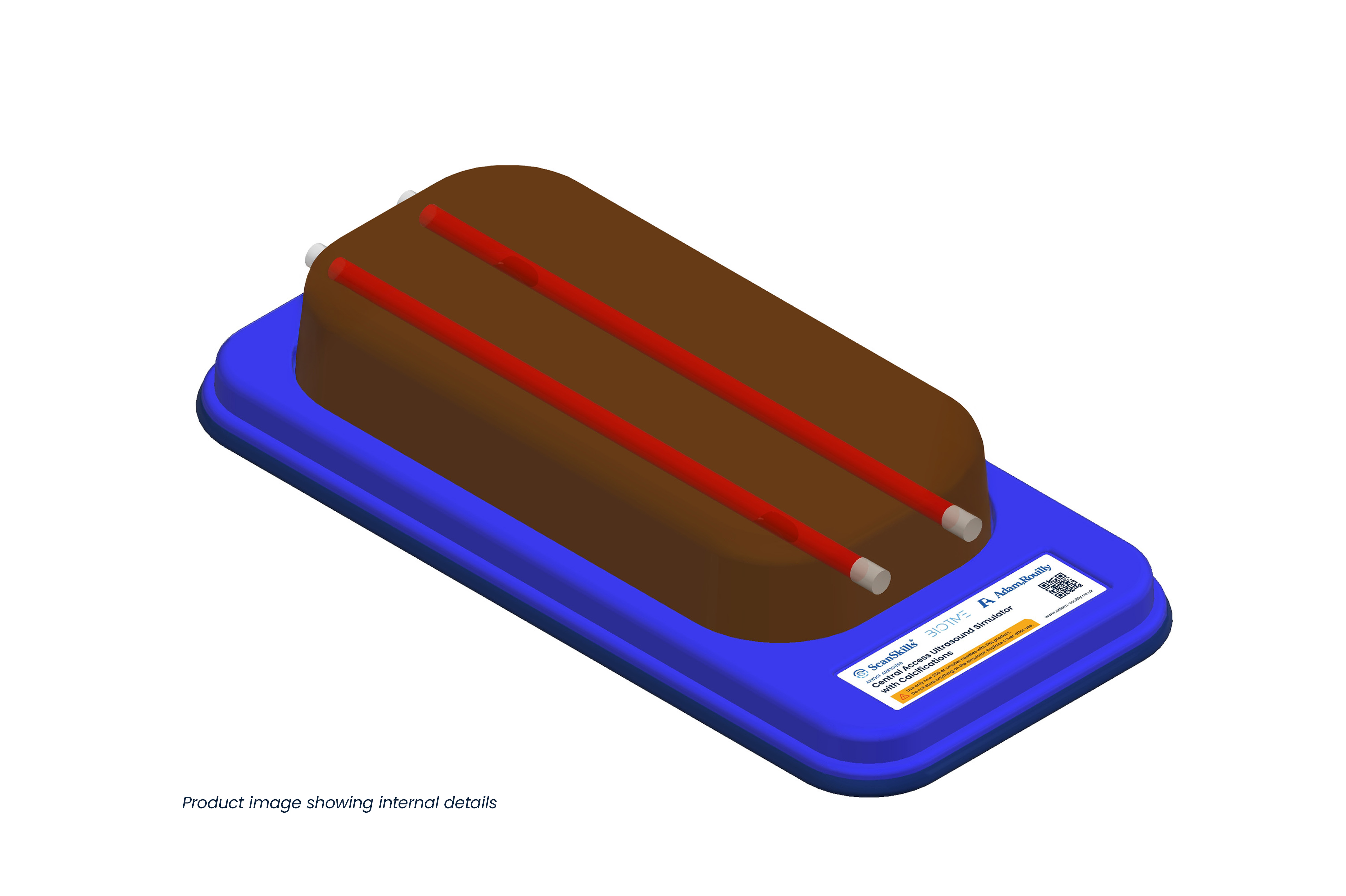 Central Access Ultrasound Simulator with Calcifications, Dark