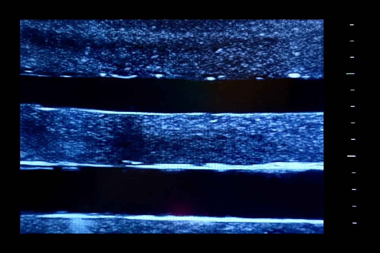 Ultrasound Simulator with 4 Central Lines, Dark