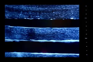 Ultrasound Simulator with 4 Central Lines, Dark