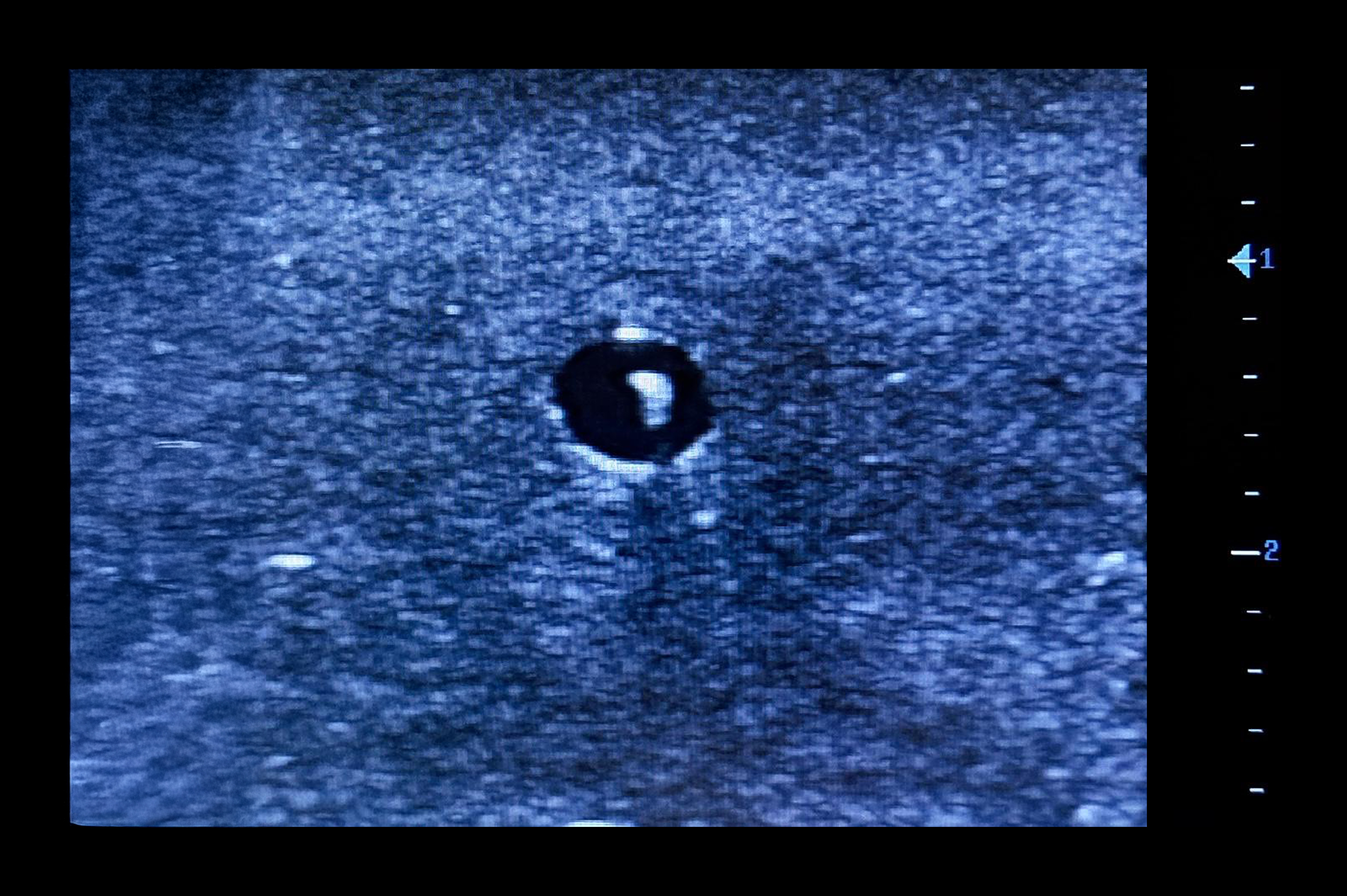 Ultrasound Simulator for Radial Artery Catheterisation, Light