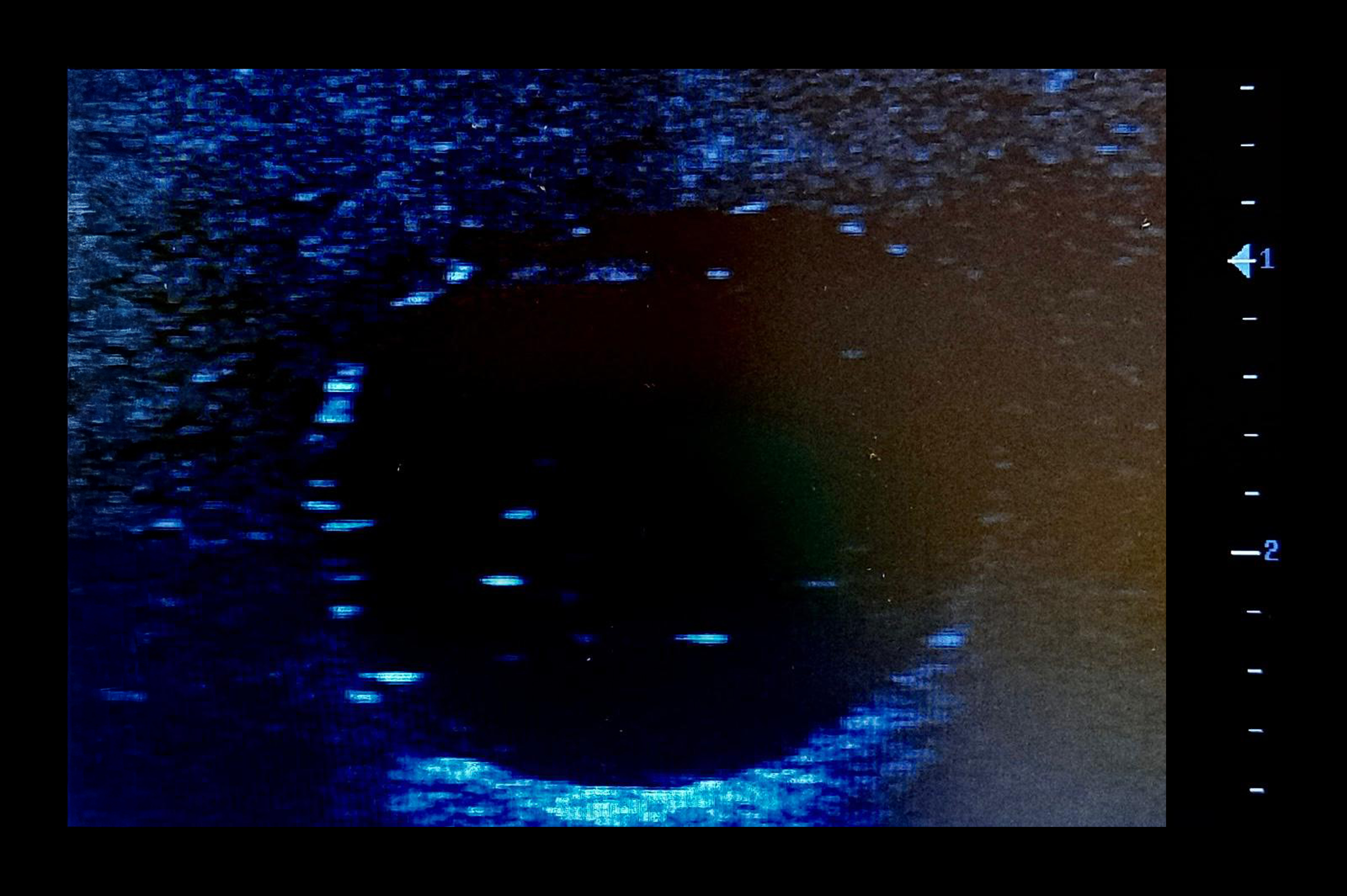 Ultrasound Simulator with Breast Pathologies/Biopsy, Light