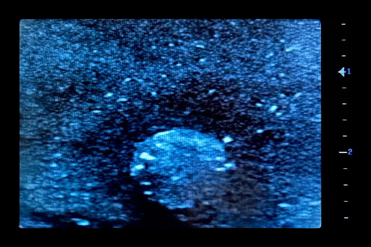 Ultrasound Simulator with Breast Pathologies/Biopsy, Dark