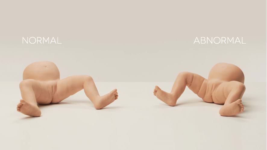 Infant Hip Examination Trainer, Light (2 Baby Pack)