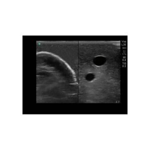 Gen II Central Line and Regional Anaesthesia Ultrasound Training Model With Hand Pump