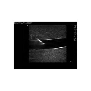 Gen II Central Line and Regional Anaesthesia Ultrasound Training Model With Hand Pump
