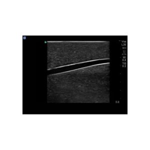 Gen II Central Line and Regional Anaesthesia Ultrasound Training Model With Hand Pump