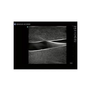 Gen II Central Line and Regional Anaesthesia Ultrasound Training Model With Hand Pump