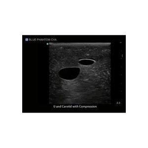 Gen II Central Line and Regional Anaesthesia Ultrasound Training Model With Hand Pump