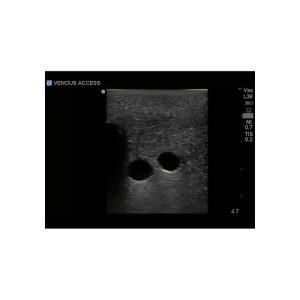 Gen II Central Line and Regional Anaesthesia Ultrasound Training Model With Hand Pump