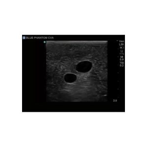 Gen II Central Line and Regional Anaesthesia Ultrasound Training Model With Hand Pump
