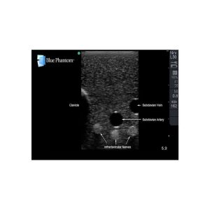 Gen II Central Line and Regional Anaesthesia Ultrasound Training Model With Hand Pump