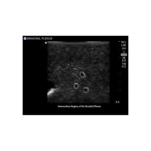 Gen II Central Line and Regional Anaesthesia Ultrasound Training Model With Hand Pump