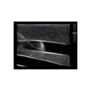Gen II Central Line and Regional Anaesthesia Ultrasound Training Model With Hand Pump