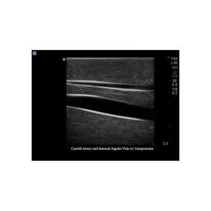 Gen II Central Line and Regional Anaesthesia Ultrasound Training Model With Hand Pump
