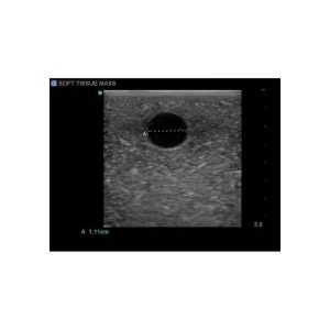 Breast Biopsy Ultrasound Training Model, EX-DEMO MODEL