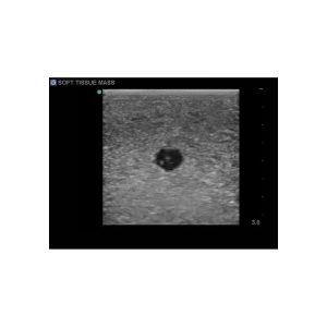 Breast Biopsy Ultrasound Training Model, EX-DEMO MODEL