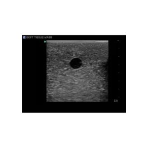 Breast Biopsy Ultrasound Training Model, EX-DEMO MODEL